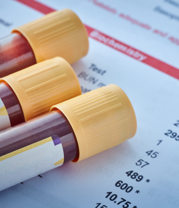 لوحة الاختبار المتقدمة