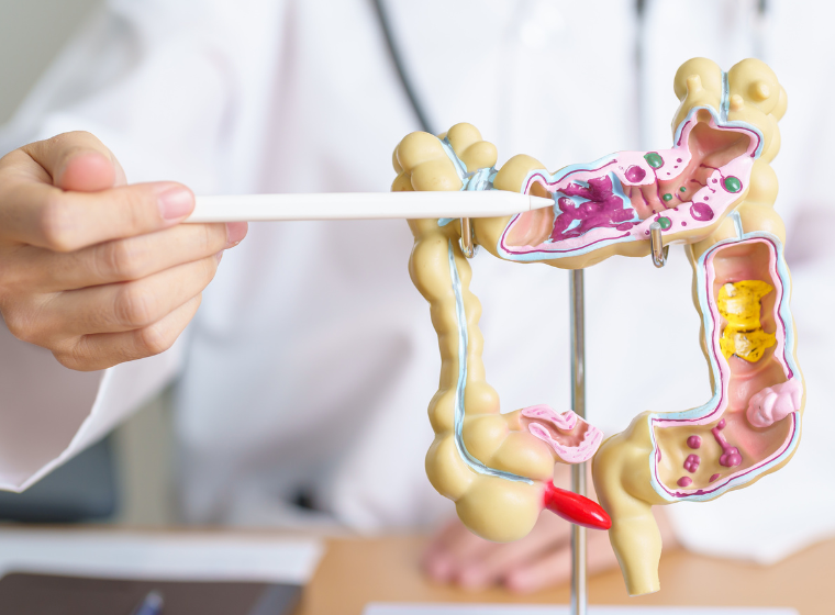 Dépistage par coloscopie pour la détection précoce du cancer colorectal en Turquie