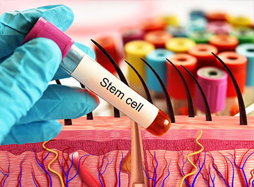 Do exosomes really work for hair loss? 