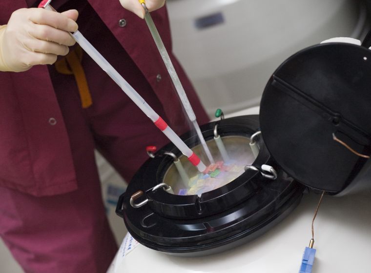 Processus de congélation des ovules: guide pour préserver la fertilité