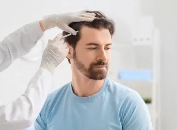 Haartransplantation in der Türkei