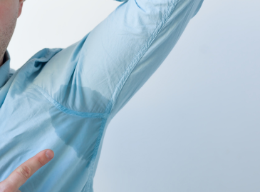 How Do I Fix Hyperhidrosis?