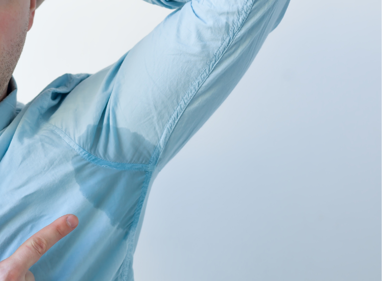 How Do I Fix Hyperhidrosis?