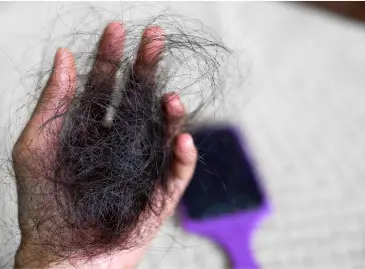 How Successful Are Stem Cell Transplants for Hair Loss