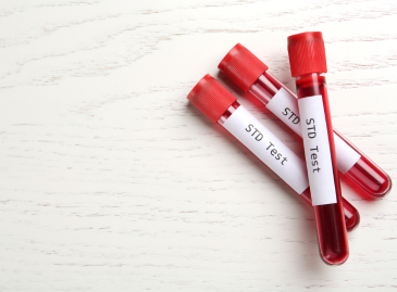 How to Get Tested for STDs
