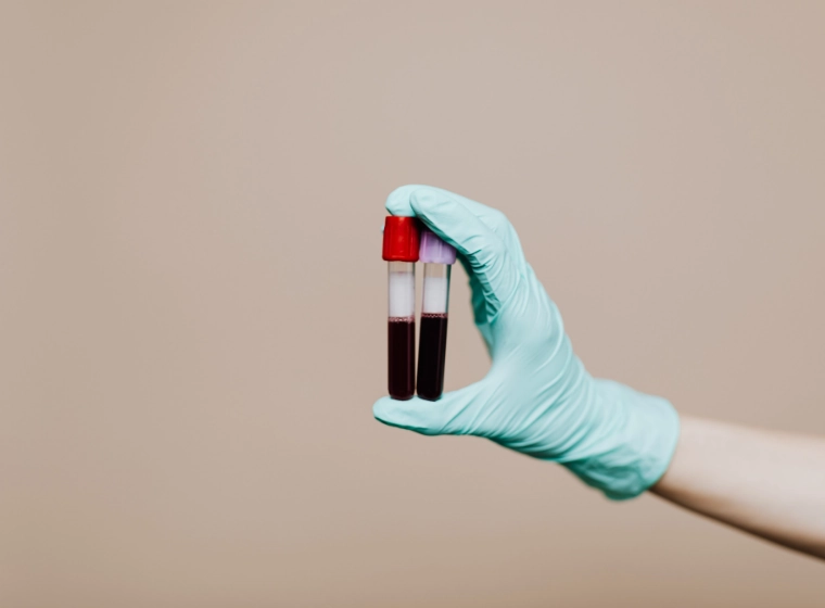 Total Body Check-Up Tests: What Each Test Detects