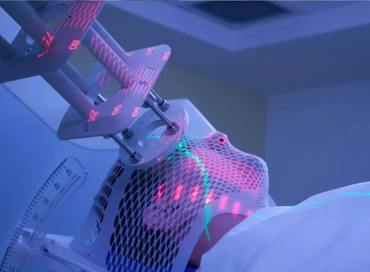 What Is Stereotactic Radiotherapy?