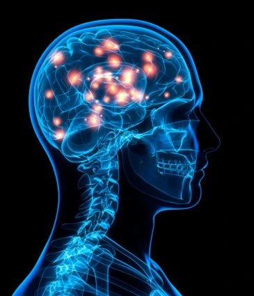 Deep Brain Stimulation for Parkinson's