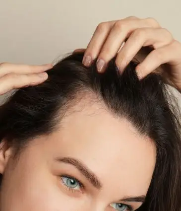Greffe de cheveux femme Istanbul