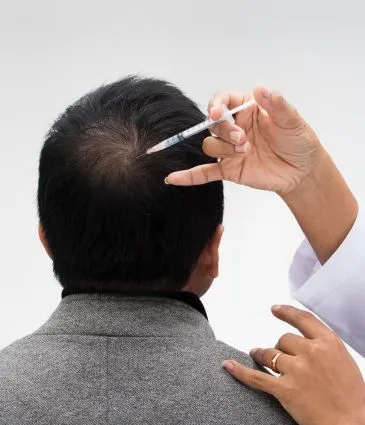Hair Transplant Package Options