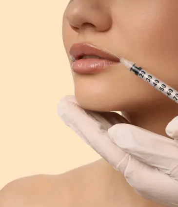 Lip Filler
