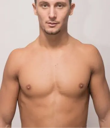 Prix ​​de la Traitement du pectus excavatum en Turquie