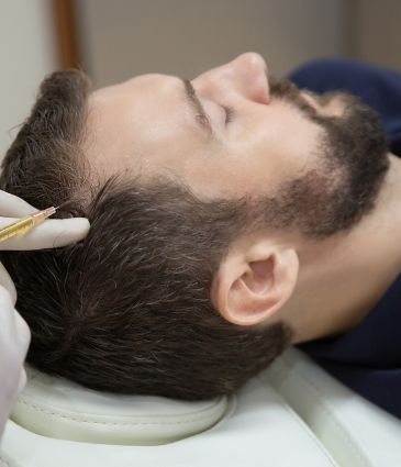 PRP Hair Treatment Price Turkey