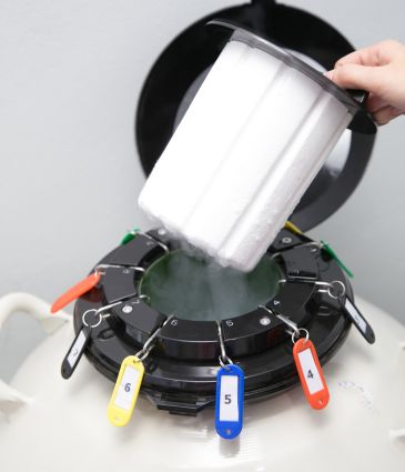 Sperm Freezing Price Turkey