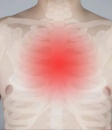 Behandlung des Thoracic-Outlet-Syndroms