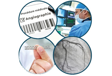 Coronary Angiography