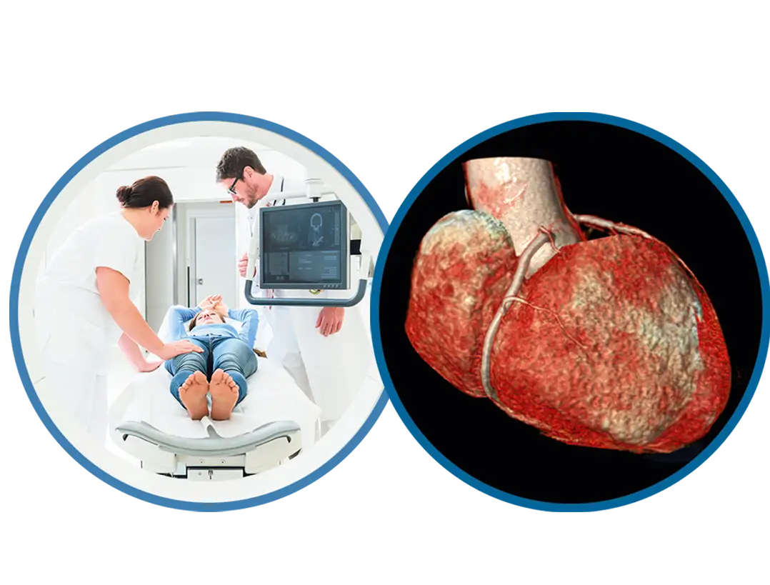 Coronary CT Angiography